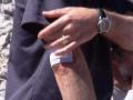 James' injuries after the fall